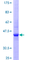 IL22 Protein - 12.5% SDS-PAGE of human IL22 stained with Coomassie Blue