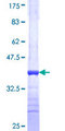 IL22 Protein - 12.5% SDS-PAGE Stained with Coomassie Blue.