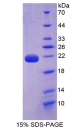 IL22 Protein - Recombinant Interleukin 22 By SDS-PAGE