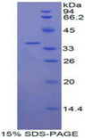 IL22 Receptor Protein - Recombinant Interleukin 22 Receptor By SDS-PAGE