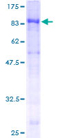 IL22RA1 / IL22R Protein - 12.5% SDS-PAGE of human IL22RA1 stained with Coomassie Blue