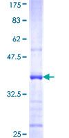 IL22RA1 / IL22R Protein - 12.5% SDS-PAGE Stained with Coomassie Blue.
