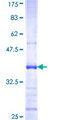 IL22RA1 / IL22R Protein - 12.5% SDS-PAGE Stained with Coomassie Blue.