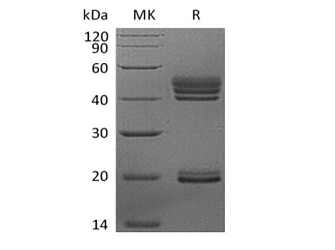 IL23A / IL-23 p19 Protein - Recombinant Human Interleukin-23/IL-23 (C-6His)