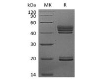 IL23A / IL-23 p19 Protein - Recombinant Human Interleukin-23/IL-23 (C-6His)