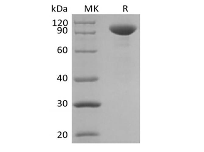 IL23A / IL-23 p19 Protein - Recombinant Human Interleukin-23/IL-23 (C-Fc)
