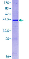 IL23A / IL-23 p19 Protein - 12.5% SDS-PAGE of human IL23A stained with Coomassie Blue