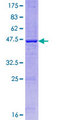 IL23A / IL-23 p19 Protein - 12.5% SDS-PAGE of human IL23A stained with Coomassie Blue