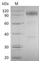 IL23R Protein - (Tris-Glycine gel) Discontinuous SDS-PAGE (reduced) with 5% enrichment gel and 15% separation gel.