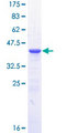 IL23R Protein - 12.5% SDS-PAGE Stained with Coomassie Blue.