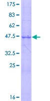 IL24 Protein - 12.5% SDS-PAGE of human IL24 stained with Coomassie Blue