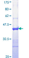 IL24 Protein - 12.5% SDS-PAGE Stained with Coomassie Blue.