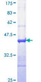 IL24 Protein - 12.5% SDS-PAGE Stained with Coomassie Blue.