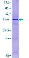 IL25 / IL17E Protein - 12.5% SDS-PAGE of human IL17E stained with Coomassie Blue