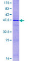 IL25 / IL17E Protein - 12.5% SDS-PAGE of human IL17E stained with Coomassie Blue