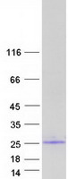IL25 / IL17E Protein - Purified recombinant protein IL25 was analyzed by SDS-PAGE gel and Coomassie Blue Staining