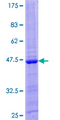 IL26 Protein - 12.5% SDS-PAGE of human IL26 stained with Coomassie Blue