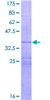 IL26 Protein - 12.5% SDS-PAGE Stained with Coomassie Blue.
