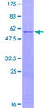 IL27 Protein - 12.5% SDS-PAGE of human IL27 stained with Coomassie Blue