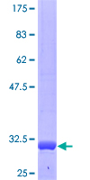 IL27 Protein - 12.5% SDS-PAGE Stained with Coomassie Blue.