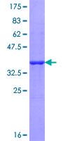 IL27RA Protein - 12.5% SDS-PAGE Stained with Coomassie Blue.