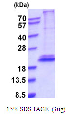 IL28B Protein