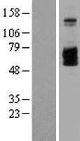 IL2RB / CD122 Protein - Western validation with an anti-DDK antibody * L: Control HEK293 lysate R: Over-expression lysate