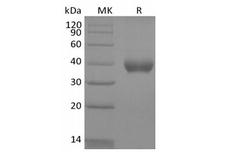 IL2RB / CD122 Protein - Recombinant Human IL-2 Receptor Subunit Beta/IL-2RB/CD122 (C-6His-Avi) Biotinylated