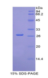 IL2RB / CD122 Protein - Recombinant Interleukin 2 Receptor Beta (IL2Rb) by SDS-PAGE