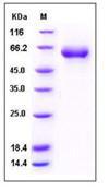 IL2RB / CD122 Protein