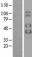 IL2RG / CD132 Protein - Western validation with an anti-DDK antibody * L: Control HEK293 lysate R: Over-expression lysate