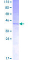IL3 Protein - 12.5% SDS-PAGE of human IL3 stained with Coomassie Blue