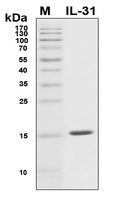 IL31 Protein