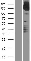 IL31RA Protein - Western validation with an anti-DDK antibody * L: Control HEK293 lysate R: Over-expression lysate