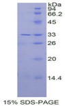 IL31RA Protein - Recombinant Interleukin 31 Receptor A By SDS-PAGE