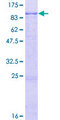 IL31RA Protein - 12.5% SDS-PAGE of human IL31RA stained with Coomassie Blue