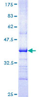 IL31RA Protein - 12.5% SDS-PAGE Stained with Coomassie Blue.