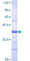 IL31RA Protein - 12.5% SDS-PAGE Stained with Coomassie Blue.