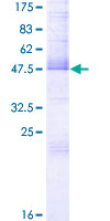 IL32 Protein - 12.5% SDS-PAGE of human IL32 stained with Coomassie Blue