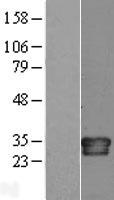 IL34 Protein - Western validation with an anti-DDK antibody * L: Control HEK293 lysate R: Over-expression lysate