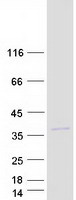 IL34 Protein - Purified recombinant protein IL34 was analyzed by SDS-PAGE gel and Coomassie Blue Staining