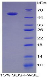 IL35 Protein - Recombinant Interleukin 35 By SDS-PAGE