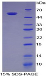 IL35 Protein - Recombinant Interleukin 35 By SDS-PAGE