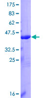 IL36A Protein - 12.5% SDS-PAGE of human IL1F6 stained with Coomassie Blue