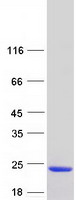 IL36A Protein - Purified recombinant protein IL36A was analyzed by SDS-PAGE gel and Coomassie Blue Staining