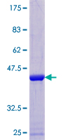 IL36B Protein - 12.5% SDS-PAGE of human IL1F8 stained with Coomassie Blue