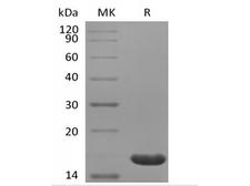 IL36B Protein - Recombinant Human IL-36 Beta/IL-1F8(153AA)