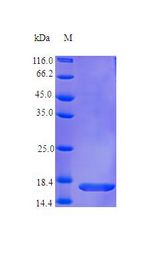 IL36RN / IL1F5 Protein