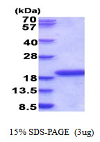 IL36RN / IL1F5 Protein