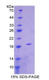 IL36RN / IL1F5 Protein - Recombinant Interleukin 1 Delta By SDS-PAGE